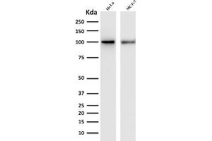 Western Blot Analysis of human HeLa and MCF-7 cell lysate with ENAH / MENA Mouse Monoclonal Antibody (ENAH/1988). (ENAH 抗体  (AA 485-589))