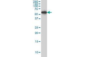 HDAC1 monoclonal antibody (M06), clone 1D6 Western Blot analysis of HDAC1 expression in Hela S3 NE . (HDAC1 抗体  (AA 1-482))