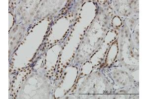 Image no. 5 for anti-Decapping Enzyme, Scavenger (DCPS) (AA 1-338) antibody (ABIN599227) (DCPS 抗体  (AA 1-338))