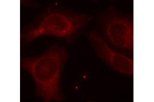 Immunofluorescence staining of methanol-fixed Hela cells using Phospho-NFKB1-S927 antibody.