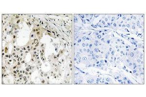 Immunohistochemistry (IHC) image for anti-Eukaryotic Translation Initiation Factor 3, Subunit D (EIF3D) (Internal Region) antibody (ABIN1851320) (EIF3D 抗体  (Internal Region))