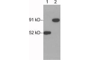 Western blot analysis of His-fusion protein (MW~91 kD) using 1 µg/mL Rabbit Anti-His-tag Polyclonal Antibody (ABIN398410) Lane 1: His-tag fusion protein expressed in E. (His Tag 抗体)