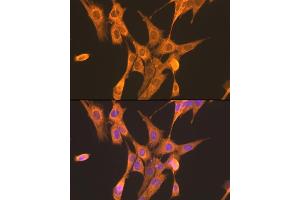 Immunofluorescence analysis of NIH/3T3 cells using PFKL antibody (ABIN7269308) at dilution of 1:100. (PFKL 抗体  (AA 700-780))