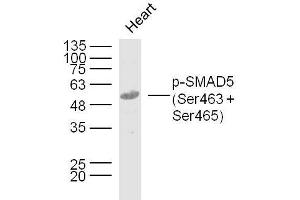 Mouse heart lysates probed with SMAD5 (Ser463 + Ser465) Polyclonal Antibody, Unconjugated  at 1:300 dilution and 4˚C overnight incubation. (SMAD5 抗体  (pSer463, pSer465))