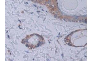 Detection of STAT2 in Rat Skin Tissue using Polyclonal Antibody to Signal Transducer And Activator Of Transcription 2 (STAT2)