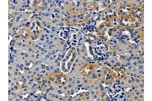 ABIN7097157 and ABIN7101225 at 1/100 staining mouse kidney tissue by IHC-P. (MANBA 抗体)