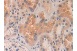 DAB staining on IHC-P; Samples: Human Kidney Tissue (MMP24 抗体  (AA 429-642))