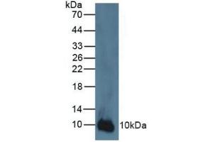 Rabbit Detection antibody from the kit in WB with Positive Control: Human A431 cells. (S100A2 ELISA 试剂盒)