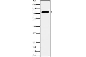 Western blot analysis of SEC24D expression in HeLa cell lysate. (Recombinant SEC24D 抗体)