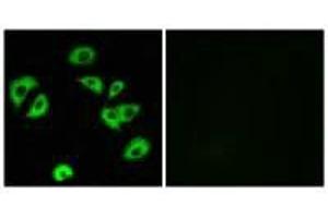 Immunofluorescence analysis of A549 cells, using LILRB4 antibody. (LILRB4 抗体)