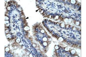 Image no. 1 for anti-Keratin 15 (KRT15) (C-Term) antibody (ABIN6735909) (KRT15 抗体  (C-Term))
