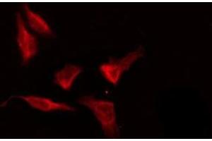 ABIN6276189 staining HeLa by IF/ICC. (OR8G5 抗体  (Internal Region))