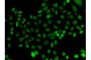 Immunofluorescence analysis of MCF-7 cells using NFYB antibody (ABIN5974397). (NFYB 抗体)