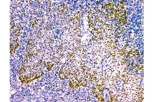 IHC analysis of NFIA using anti-NFIA antibody (ABIN6719349). (NFIA 抗体  (Middle Region))