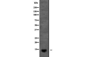 Western blot analysis of KCNE2 expression in Pancreas (Mouse) Tissue Lysate ,The lane on the left is treated with the antigen-specific peptide. (KCNE2 抗体  (Internal Region))