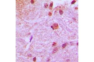 Immunohistochemical analysis of RUNX2 staining in human brain formalin fixed paraffin embedded tissue section.