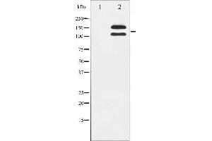Western blot analysis of c-Kit phosphorylation expression in HeLa whole cell lysates,The lane on the left is treated with the antigen-specific peptide. (KIT 抗体  (pTyr721))