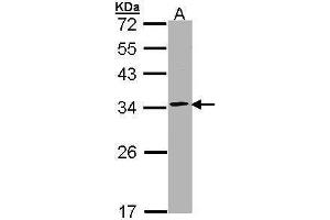 WB Image Sample (30 ug of whole cell lysate) A: Raji 12% SDS PAGE antibody diluted at 1:1000 (Proteasome 20S alpha 1 (Center) 抗体)