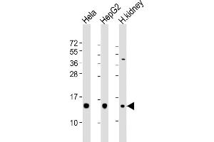 All lanes : Anti-PFN1 Antibody (C-term) at 1:2000 dilution Lane 1: Hela whole cell lysates Lane 2: HepG2 whole cell lysates Lane 3: human kidney lysates Lysates/proteins at 20 μg per lane. (PFN1 抗体  (C-Term))