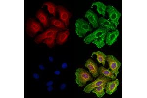 ABIN7094516 and ABIN7098565 staining Hela cells by IF/ICC. (CD20 抗体  (C-Term))