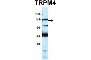 Western Blotting (WB) image for anti-Transient Receptor Potential Cation Channel, Subfamily M, Member 4 (TRPM4) (N-Term) antibody (ABIN2776221)