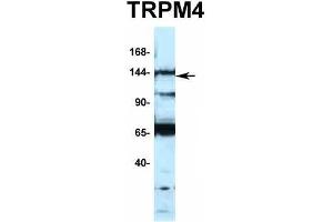 Host:  Rabbit  Target Name:  TRPM4  Sample Type:  Jurkat  Antibody Dilution:  1. (TRPM4 抗体  (N-Term))