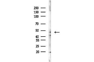 Western blot analysis of lysates from Rat brain, using DMKN Antibody at 1/1000 dilution.