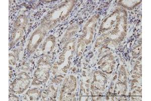 Image no. 1 for anti-Paraneoplastic Antigen MA1 (PNMA1) (AA 62-161) antibody (ABIN598600) (PNMA1 抗体  (AA 62-161))