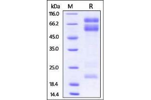 Mouse ADAM17, His Tag on SDS-PAGE under reducing (R) condition. (ADAM17 Protein (AA 18-563) (His tag))