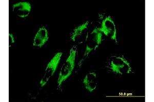 Immunofluorescence of monoclonal antibody to NNT on HepG2 cell. (NNT 抗体  (AA 1-207))