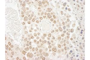 Immunohistochemistry (IHC) image for anti-Denticleless E3 Ubiquitin Protein Ligase Homolog (DTL) (C-Term) antibody (ABIN7448536) (CDT2/RAMP 抗体  (C-Term))