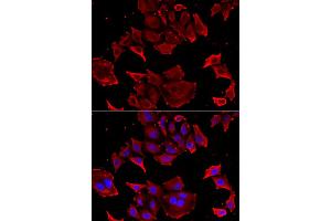 Immunofluorescence analysis of HeLa cells using TCAP antibody. (TCAP 抗体)