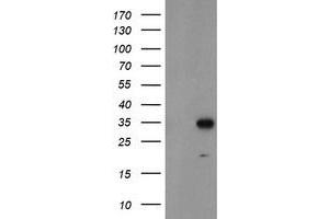Western Blotting (WB) image for anti-Myeloid Leukemia Factor 1 (MLF1) antibody (ABIN1499494) (MLF1 抗体)
