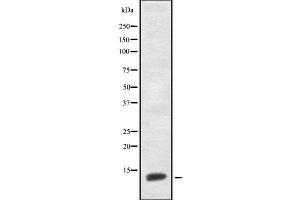 Western blot analysis of CNP-53 using HepG2 whole cell lysates (NPPC 抗体  (Internal Region))