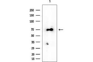 anti-Glycosyltransferase 25 Domain Containing 1 (GLT25D1) antibody
