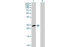 Western Blot analysis of NOP16 expression in transfected 293T cell line by NOP16 MaxPab polyclonal antibody. (NOP16 抗体  (AA 1-178))