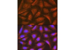 Immunofluorescence analysis of U-2 OS cells using eIF2B epsilon (EIF2B5) (EIF2B5) Rabbit mAb (ABIN7267038) at dilution of 1:100 (40x lens).