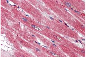 Human Heart (formalin-fixed, paraffin-embedded) stained with S100A4 antibody ABIN337243 at 2. (s100a4 抗体)