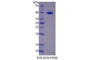 SDS-PAGE analysis of Human VGF Protein. (VGF 蛋白)