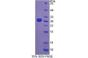 SDS-PAGE analysis of Rat DTNBP1 Protein. (DTNBP1 蛋白)