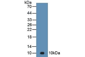 Detection of Recombinant C4b, Mouse using Polyclonal Antibody to Complement C4-B (C4B)
