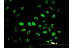 Immunofluorescence of monoclonal antibody to MPG on HeLa cell. (MPG 抗体  (AA 1-90))
