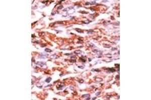 Image no. 1 for anti-Cyclin-Dependent Kinase Inhibitor 1A (p21, Cip1) (CDKN1A) (pSer130) antibody (ABIN358179) (p21 抗体  (pSer130))