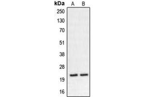 Western blot analysis of CHP2 expression in K562 (A), HT29 (B) whole cell lysates. (Chp2 抗体  (Center))
