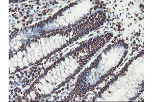 Image no. 16 for anti-Non-POU Domain Containing, Octamer-Binding (NONO) (AA 184-385) antibody (ABIN1491073)