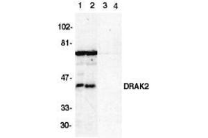 Western blot analysis of DRAK2 in Jurkat (1,3) and Raji (2,4) cell lysate in the absence (1,2) or presence (3,4) of blocking peptide with AP30303PU-N DRAK2 antibody at 1/500 dilution. (DRAK2 抗体  (C-Term))