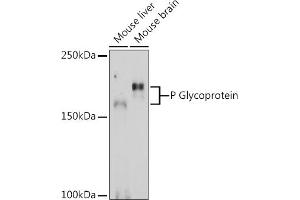 Western blot analysis of extracts of various cell lines, using P Glycoprotein Rabbit pAb (ABIN6134228, ABIN6136339, ABIN6136342 and ABIN6215442) at 1:1000 dilution. (ABCB1 抗体  (AA 600-700))