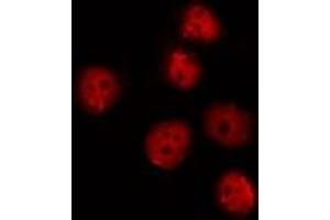 ABIN6275734 staining HepG2 by IF/ICC. (OSR2 抗体  (Internal Region))
