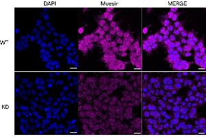 Immunocytochemical staining of HeLa cells using Moesin antibody (ABIN7799482), 1:1,000), Top panel: wild-type (WT), Bottom panal: Moesin shRNA knockdown (KD). (Recombinant Moesin 抗体)