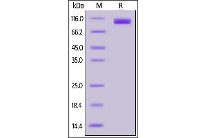 SDS-PAGE (SDS) image for Angiotensin I Converting Enzyme 2 (ACE2) protein (His tag) (ABIN6952617)